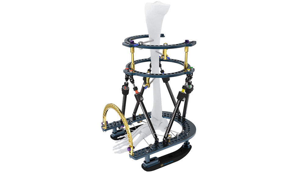 MAXFRAME Hexapod Frame