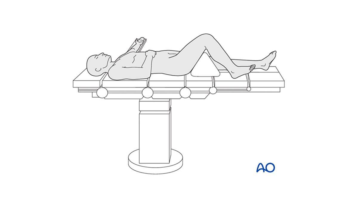 diagram of patient in a supine position with knee flexed 90 degrees