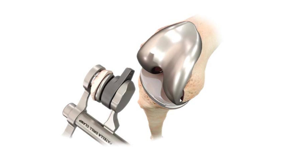 patella component implantation