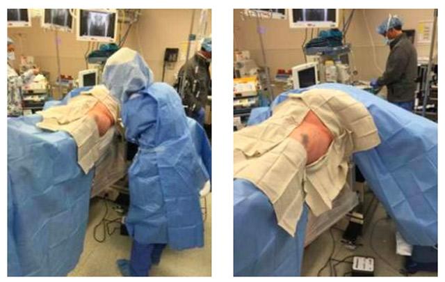 surgeons draping patient for anterior approach total hip replacement on Hana table
