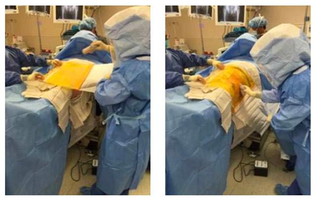 surgeons draping patient for anterior approach total hip replacement on Hana table