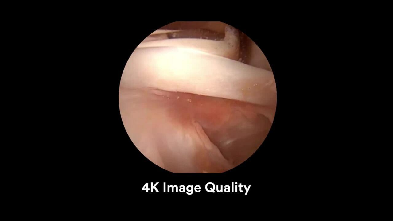 PUREVUE 4K Animation