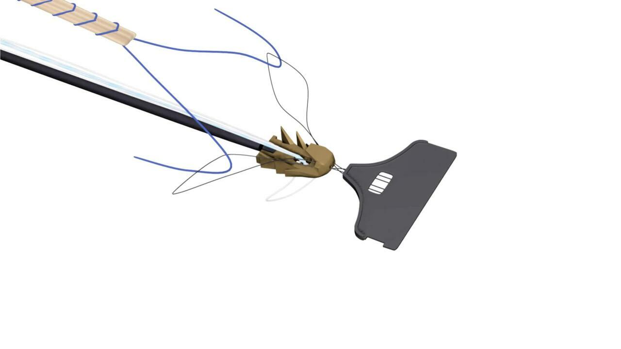 TIGHT-N Anchor Animation