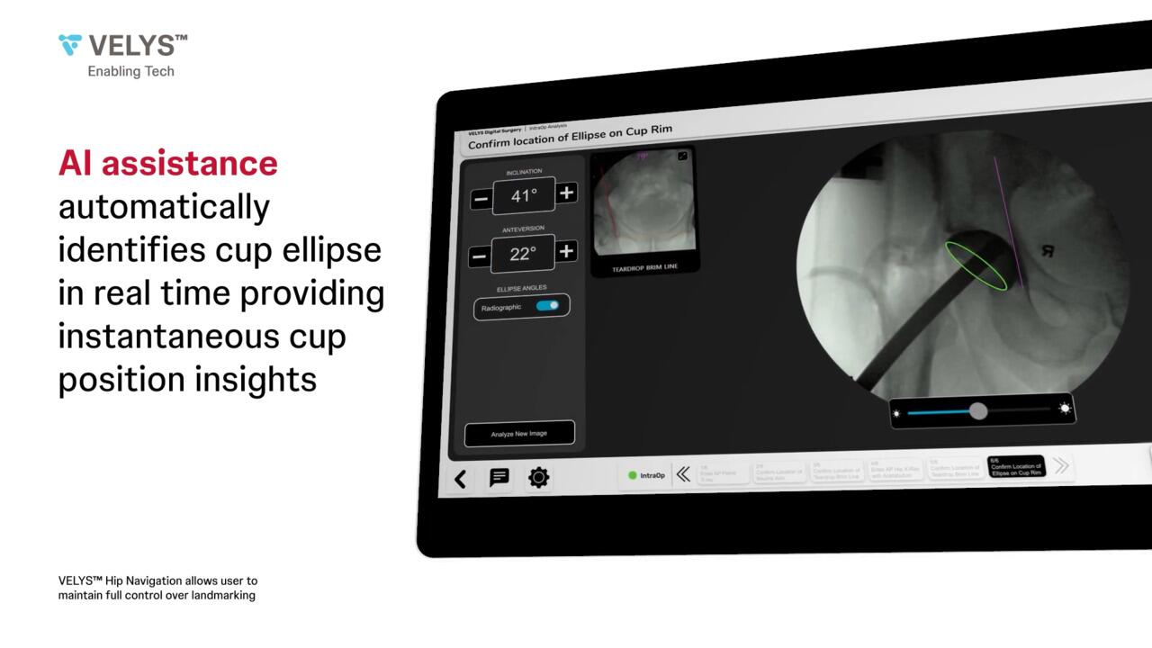 VELYS Hip Navigation Demo video