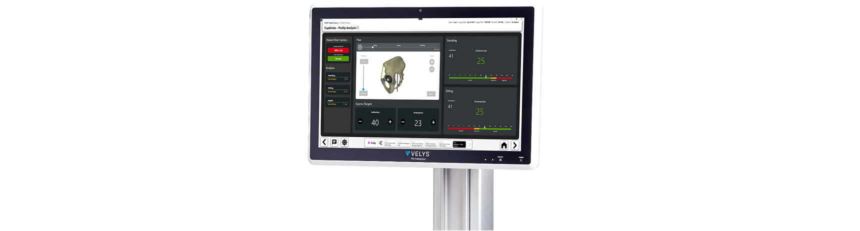 CUPTIMIZE™ Hip-Spine Analysis