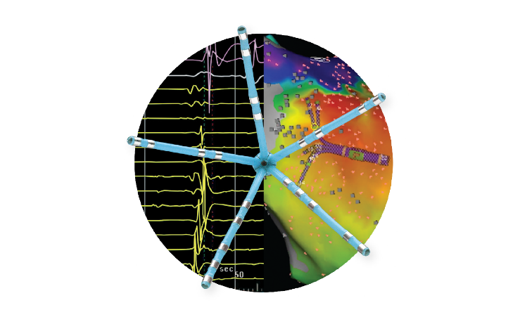 Accuracy CARTO™ PENTARAYTM NAV eco Catheter