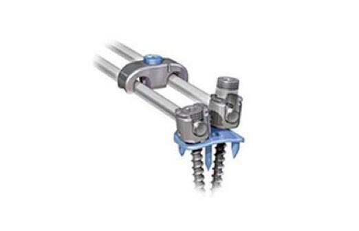 EXPEDIUM® Anterior Spine